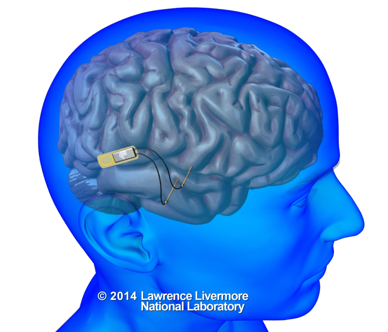 Researchers at Lawrence Livermore National Lab will develop an implantable device that will use electrical signals to communicate with individual neurons in the brain. (Courtesy of LLNL)